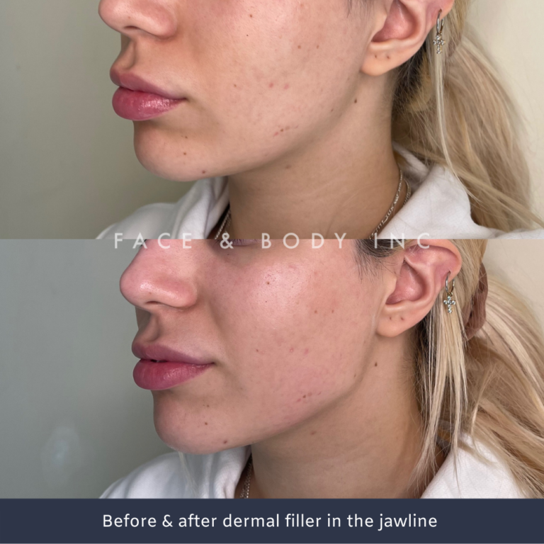 Jawline Definition Face and Body Inc