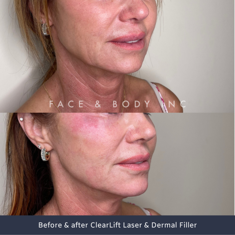 ClearLift Face & Body Inc