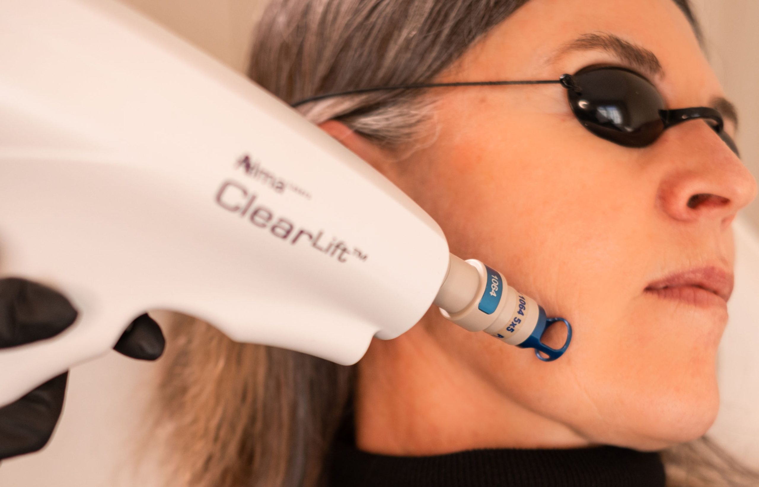 Clearlift Laser Perth