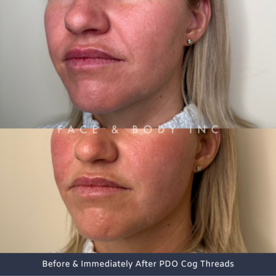 PDO Cog Threads Perth Face and Body Inc